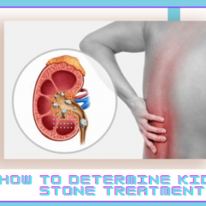 How to Determine Kidney Stone Treatment
