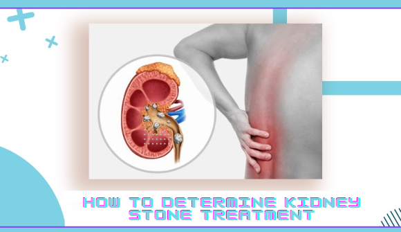 How to determine Kidney Stone Treatment How to Determine Kidney Stone Treatment