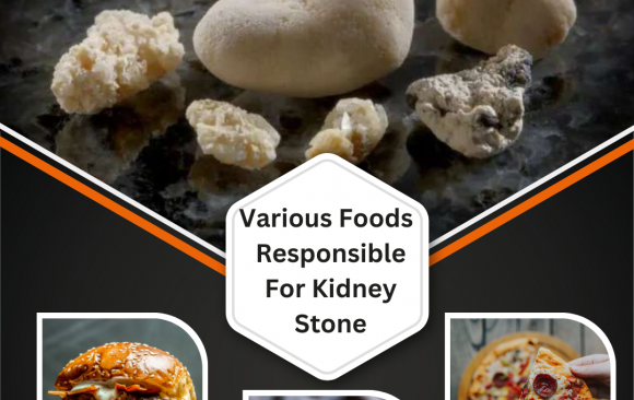 dr karan kidney Various Foods Responsible for Kidney Stones