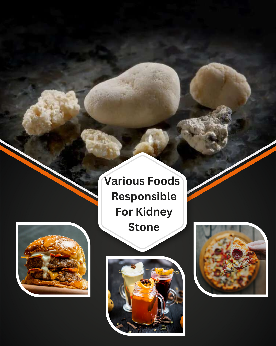 Various Foods Responsible for Kidney Stones