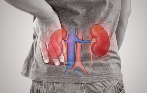 Exploring the Winter Dehydration Kidney Stones Connection