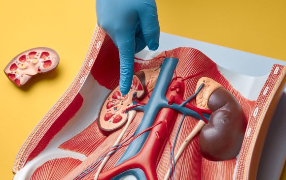 The Main Causes of Kidney Failure You Should Know